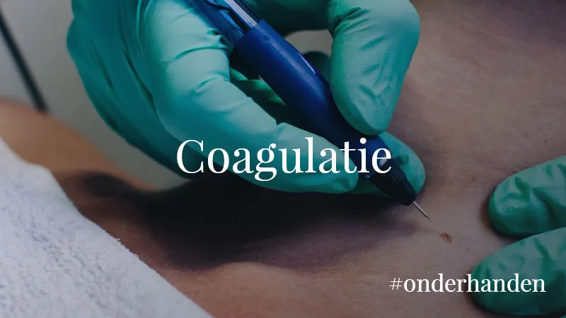 #onderhanden-coagulatie